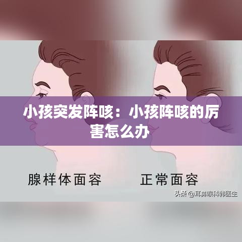 小孩突发阵咳：小孩阵咳的厉害怎么办 