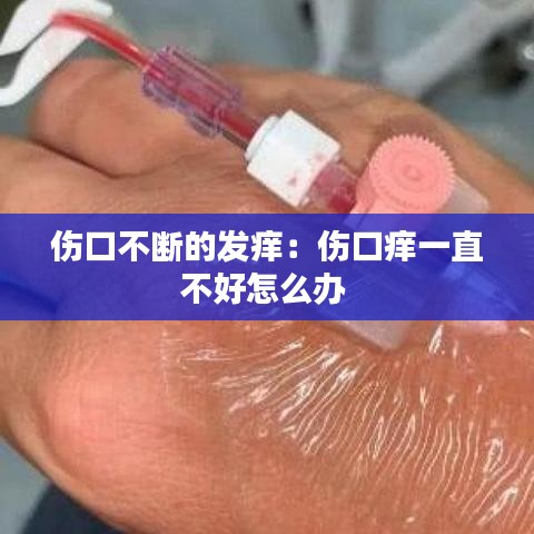 伤口不断的发痒：伤口痒一直不好怎么办 