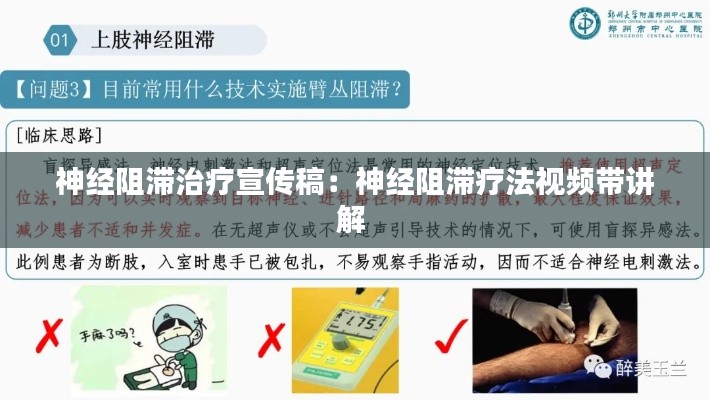 神经阻滞治疗宣传稿：神经阻滞疗法视频带讲解 
