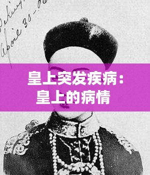 皇上突发疾病：皇上的病情 