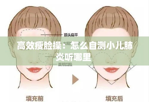 高效瘦脸操：怎么自测小儿肺炎听哪里 