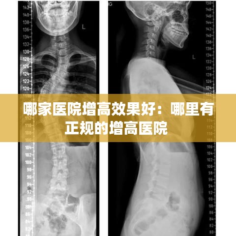 哪家医院增高效果好：哪里有正规的增高医院 