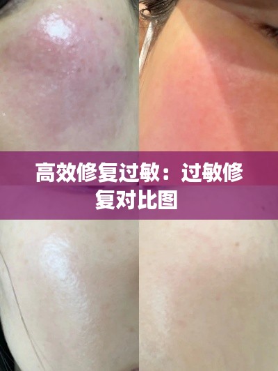 高效修复过敏：过敏修复对比图 