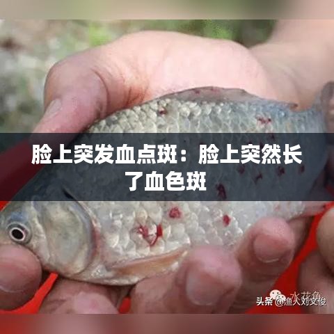 脸上突发血点斑：脸上突然长了血色斑 