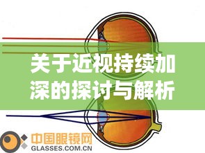 关于近视持续加深的探讨与解析