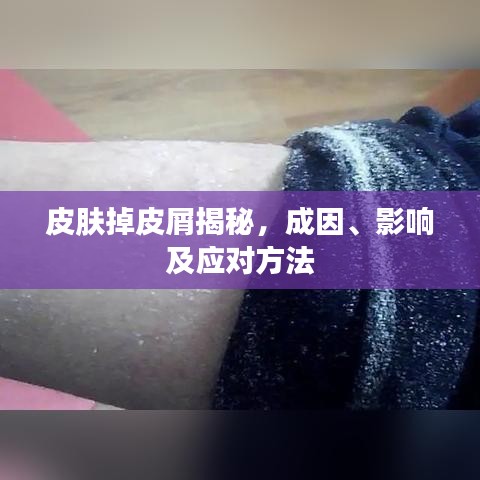 皮肤掉皮屑揭秘，成因、影响及应对方法