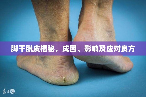 脚干脱皮揭秘，成因、影响及应对良方