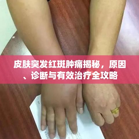 皮肤突发红斑肿痛揭秘，原因、诊断与有效治疗全攻略