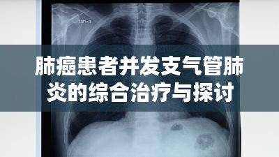 肺癌患者并发支气管肺炎的综合治疗与探讨