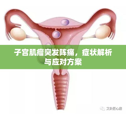 子宫肌瘤突发阵痛，症状解析与应对方案