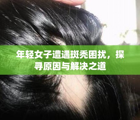 年轻女子遭遇斑秃困扰，探寻原因与解决之道